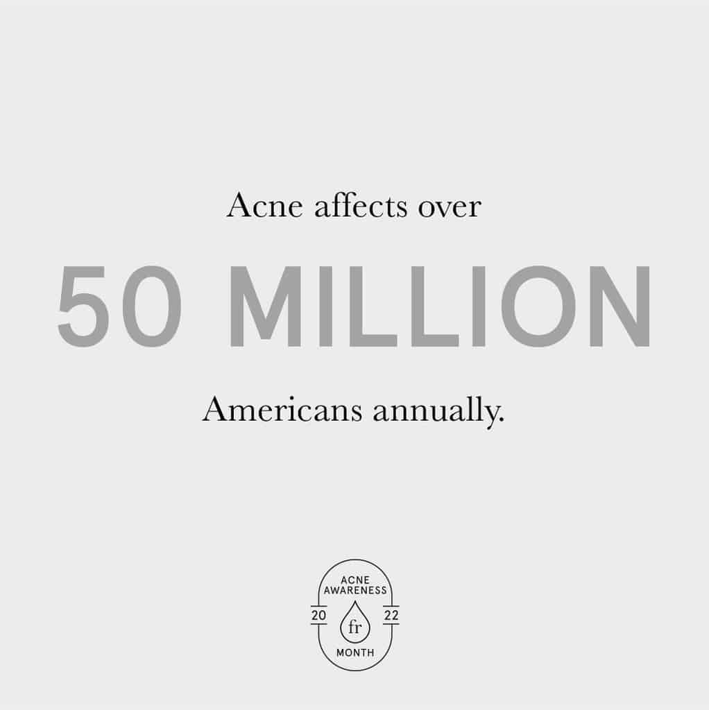 Teen and Adult acne affects 50 million 